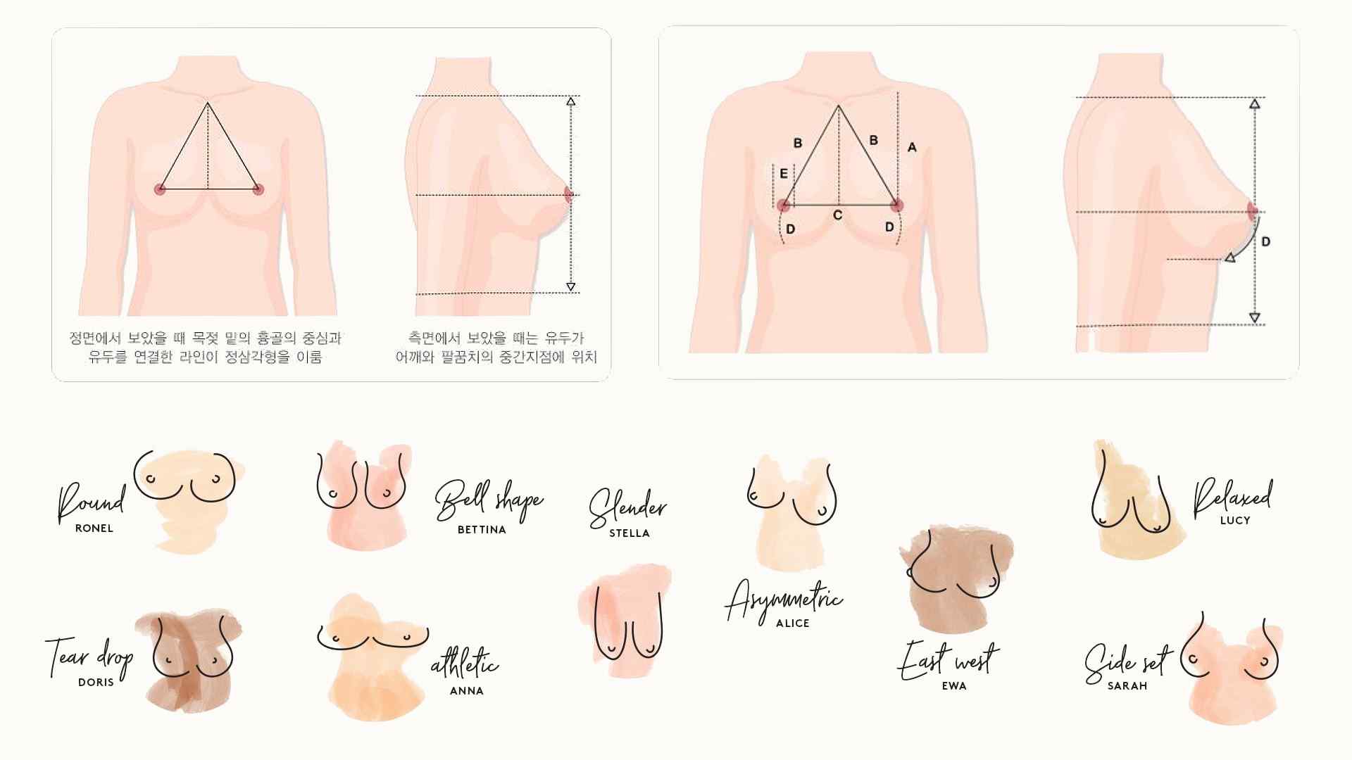 高雄隆乳手術,隆乳胸型,自我胸型檢測