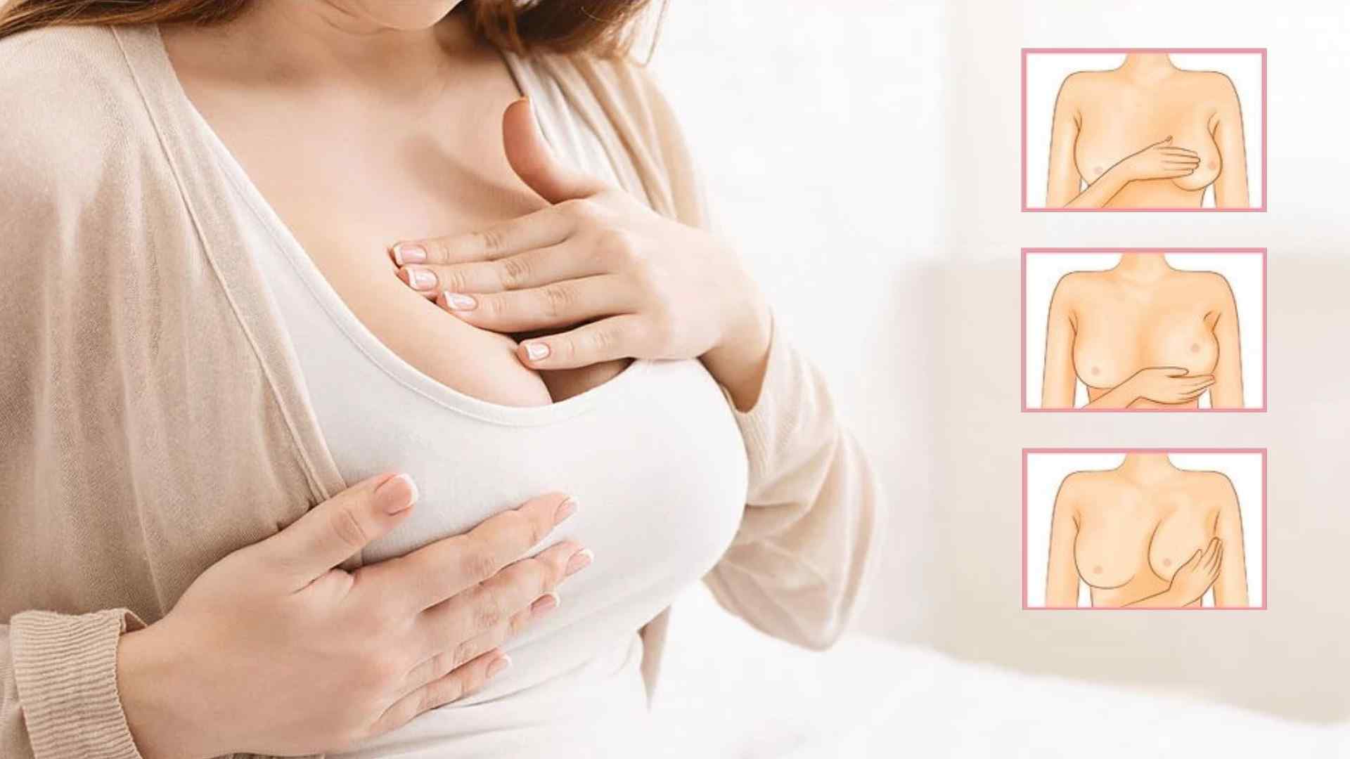 隆乳後按摩,隆乳術後保養,高雄隆乳醫美