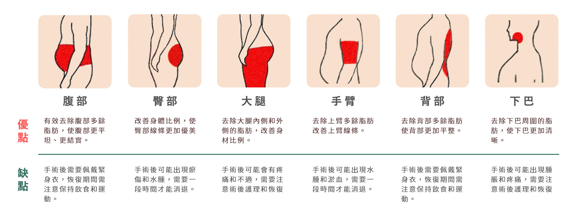 高雄抽脂手術_永恆醫美