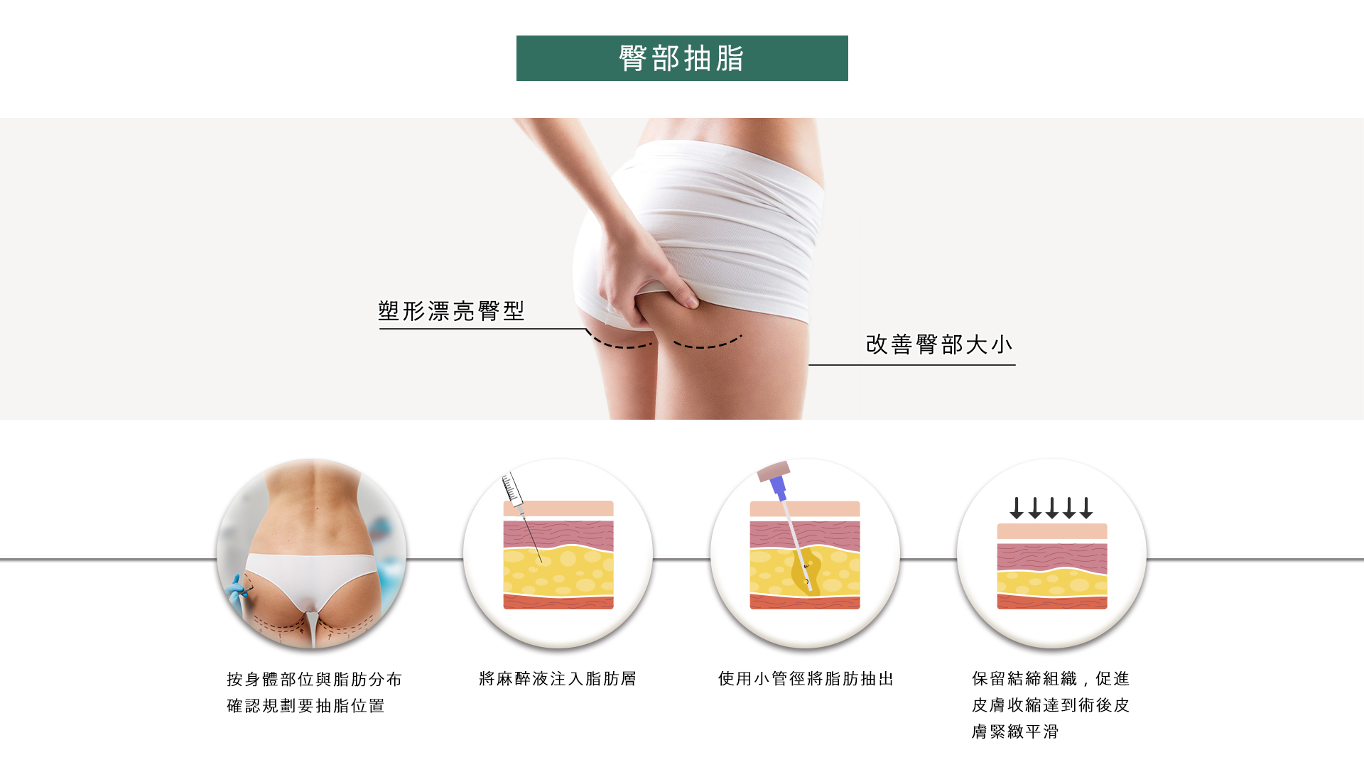 高雄抽脂手術_永恆醫美