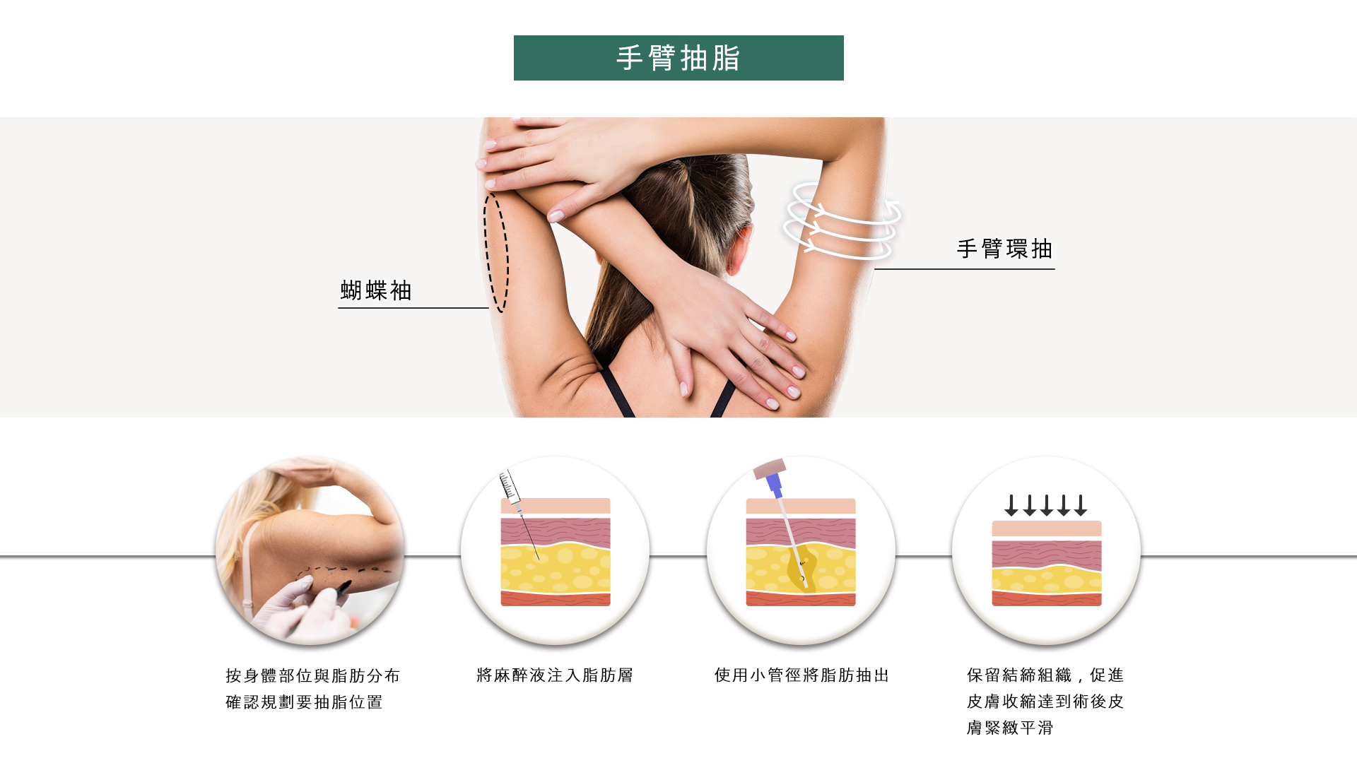 高雄抽脂手術_永恆醫美