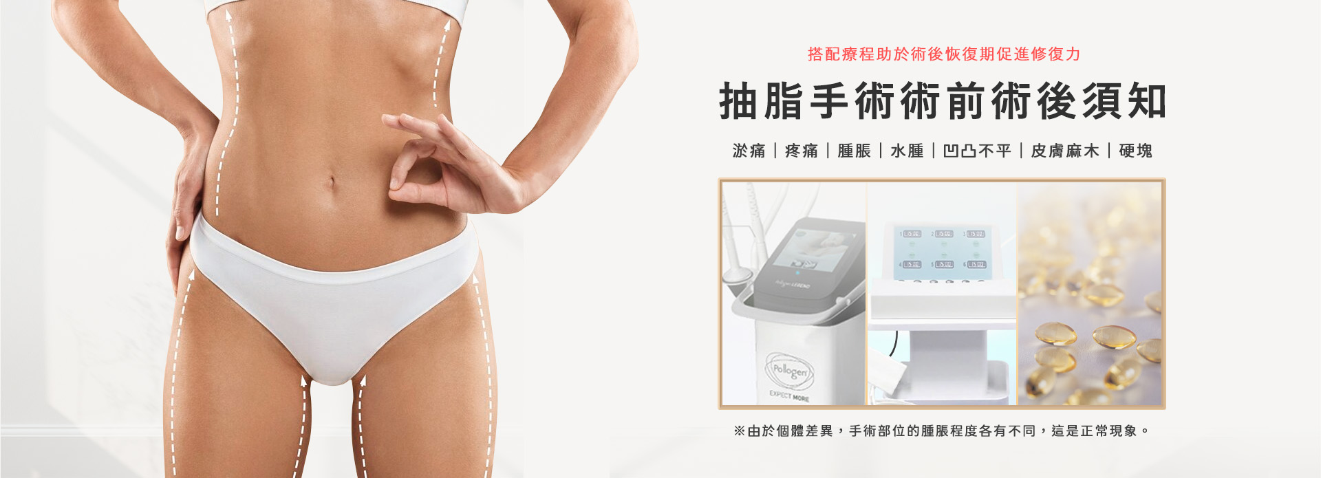 高雄抽脂手術_永恆醫美