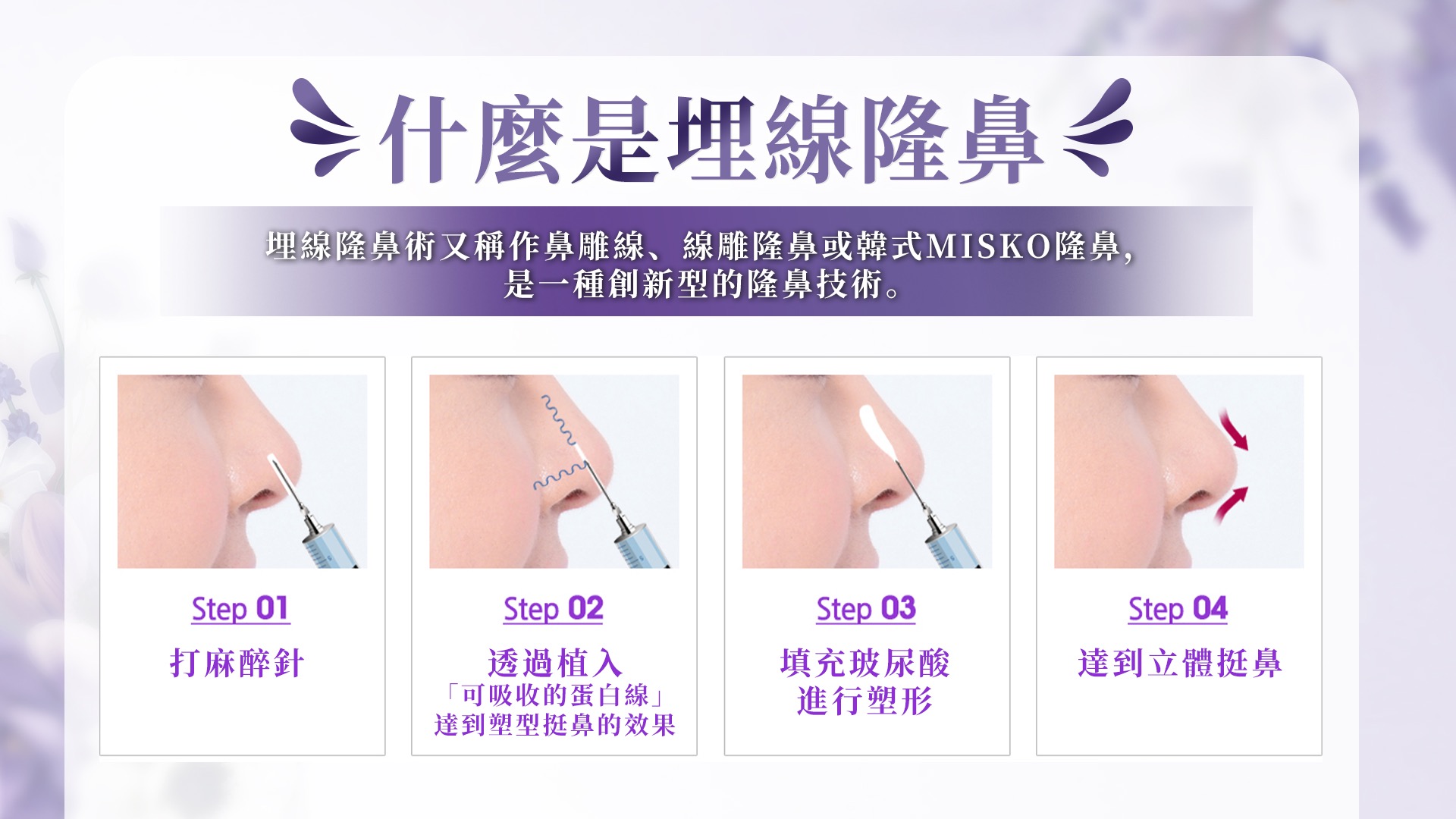 高雄埋線隆鼻權威醫師推薦價格費用002