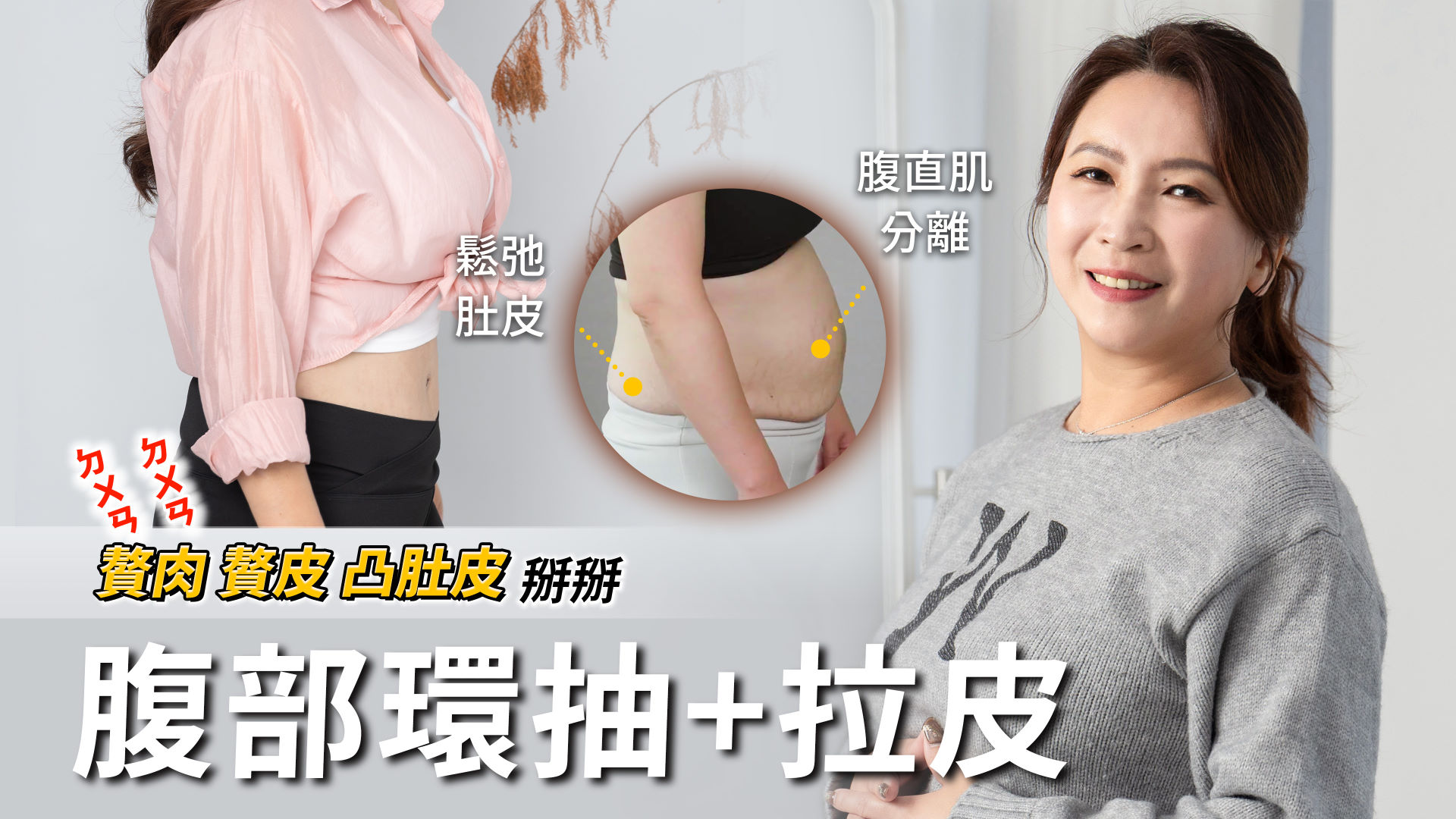 高雄腹部拉皮權威醫師推薦價格費用001