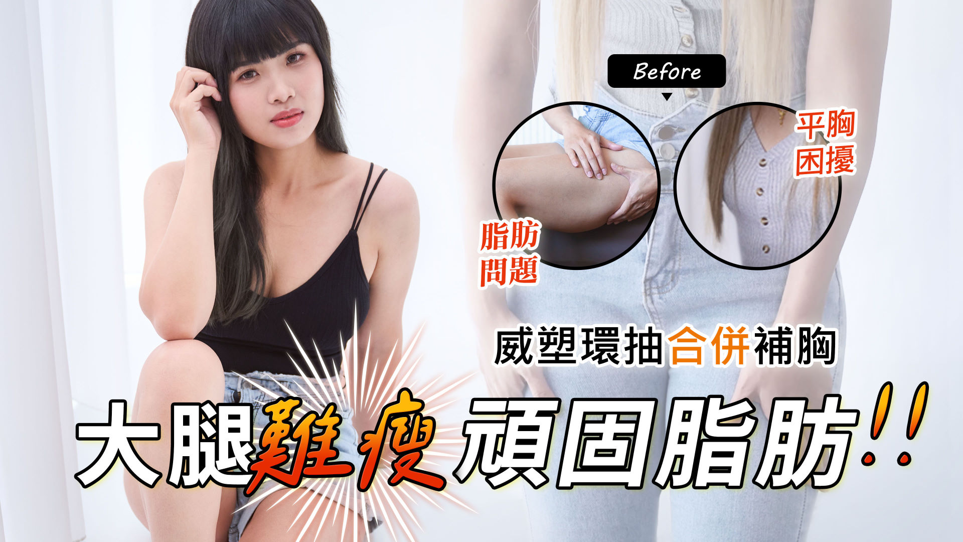 高雄抽脂推薦權威醫師永恆醫美整形01